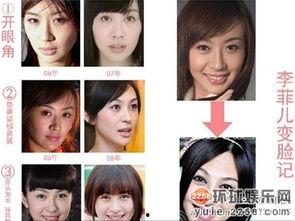 男孩整容27次爆料视频,揭秘男孩整容之路的辛酸历程