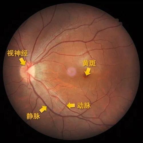 明星得眼病,明星遭遇眼部疾病的挑战与康复之路